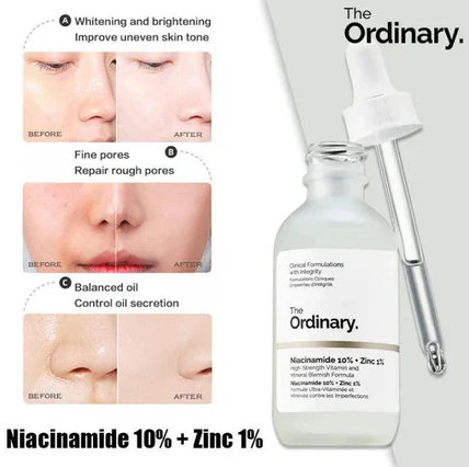 The Ordinary Niacinamide 10% + Zinc 1% Serum – Clear, Smooth & Balanced Skin | Buy 1 Get 1 Free (30ML)