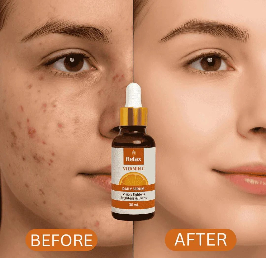 Vitamin C Daily Face Serum – Brightening, Anti-Aging & Hydrating Formula For Healthy Radiant Skin (30ml)