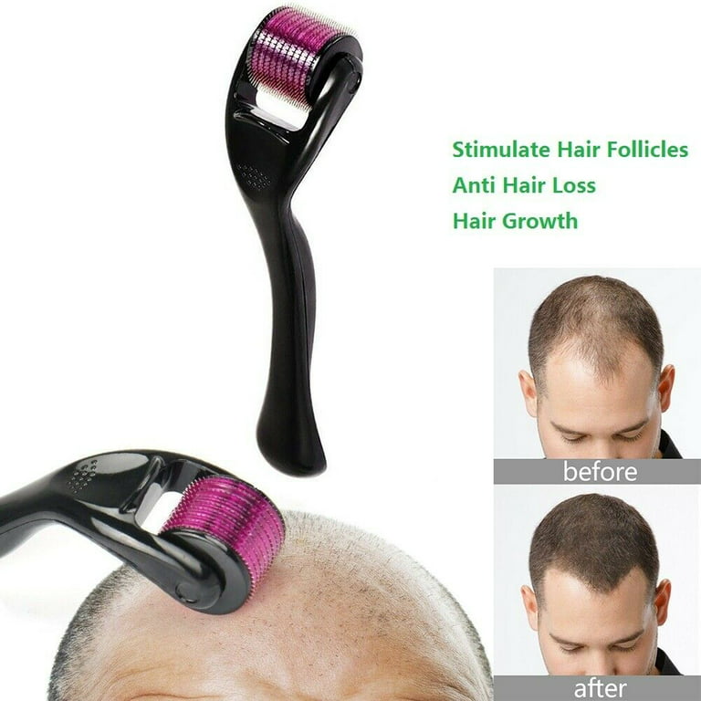 Derma Roller Facial & Hair Therapy 540 Titanium Microneedle Hair Regrowth Beard Growth Anti Hair Loss Treatment Thinning