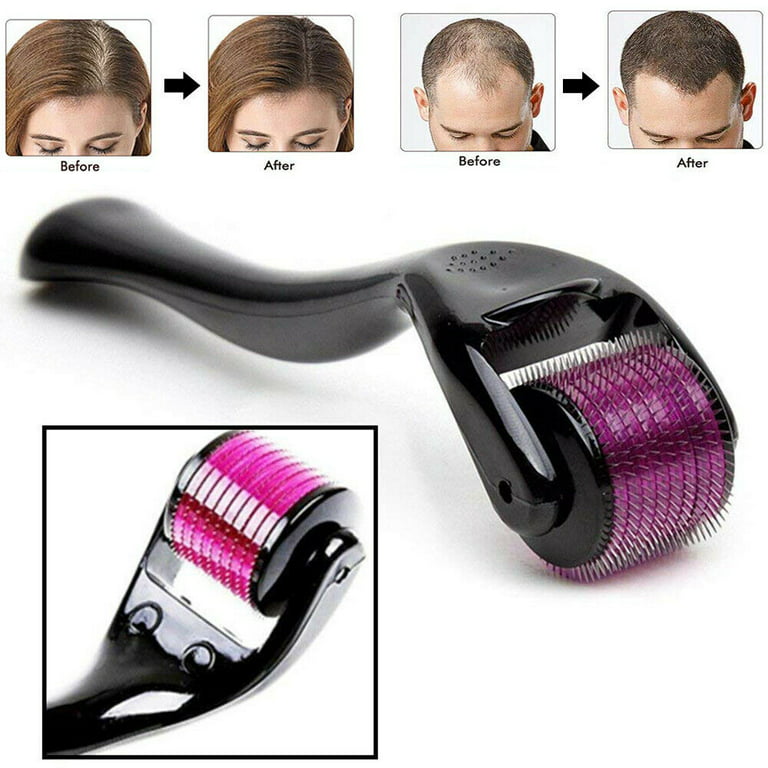 Derma Roller Facial & Hair Therapy 540 Titanium Microneedle Hair Regrowth Beard Growth Anti Hair Loss Treatment Thinning