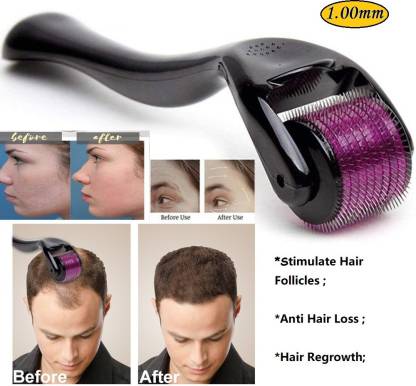 Derma Roller Facial & Hair Therapy 540 Titanium Microneedle Hair Regrowth Beard Growth Anti Hair Loss Treatment Thinning