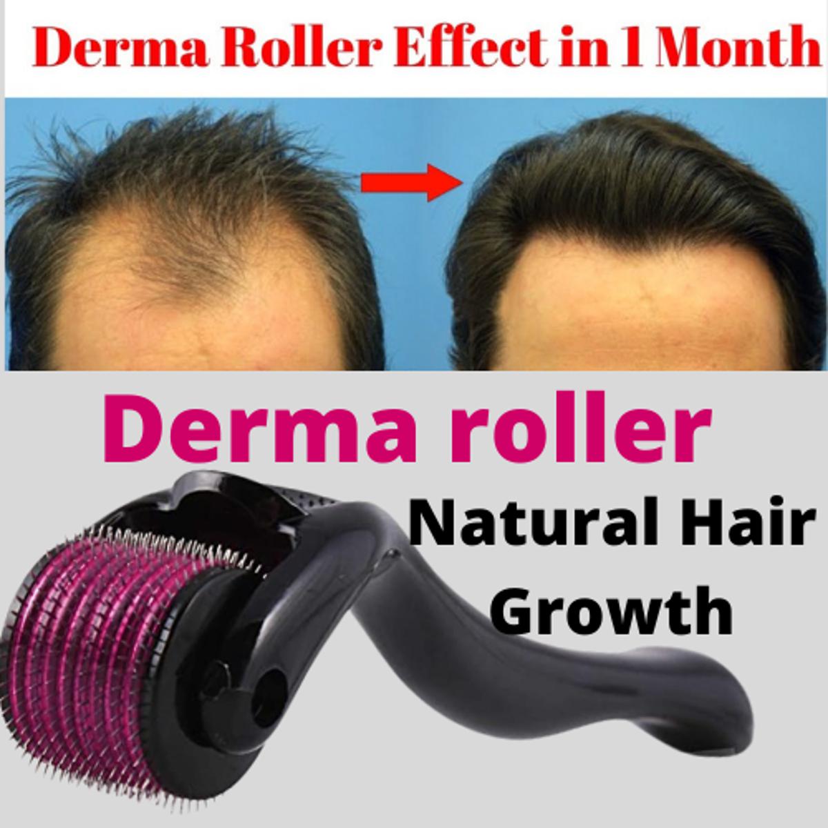 Derma Roller Facial & Hair Therapy 540 Titanium Microneedle Hair Regrowth Beard Growth Anti Hair Loss Treatment Thinning