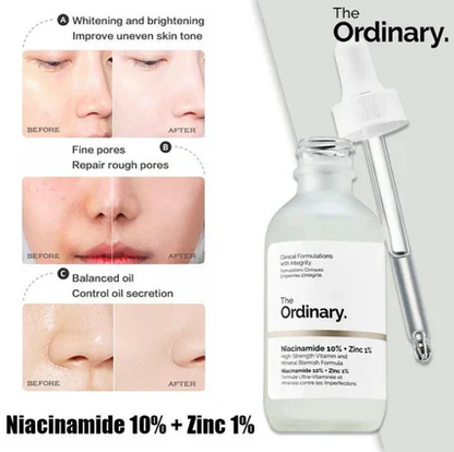 The Ordinary Niacinamide 10% + Zinc 1% Serum – Clear, Smooth & Balanced Skin | Buy 1 Get 1 Free (30ML)
